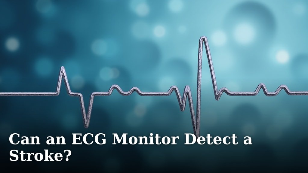 Can an ECG Monitor Detect a Stroke?