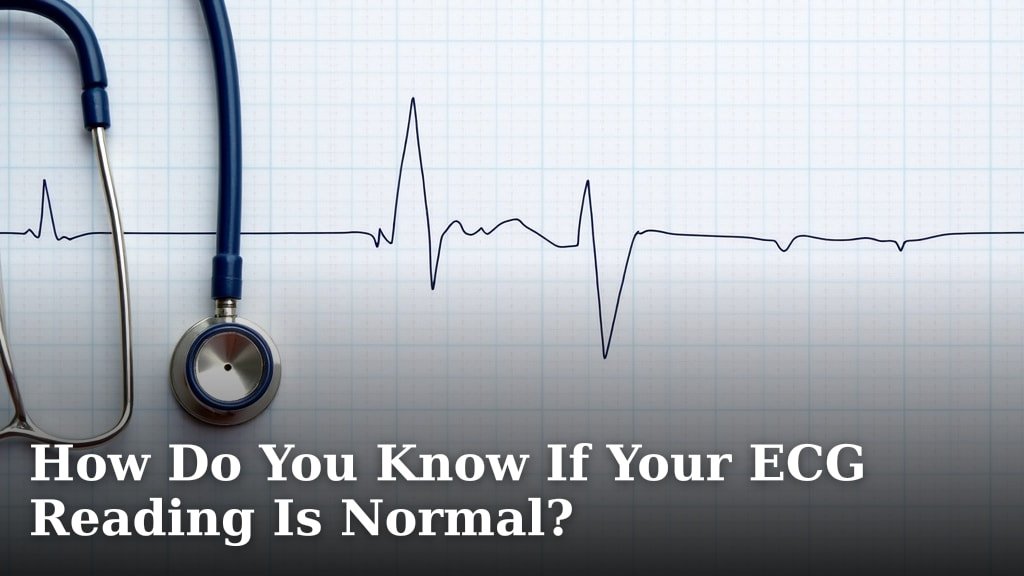 How Do You Know If Your ECG Reading Is Normal?